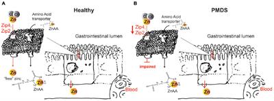 Prospects of Zinc Supplementation in Autism Spectrum Disorders and Shankopathies Such as Phelan McDermid Syndrome